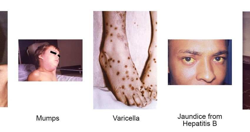 Physically Speaking - Vaccinations